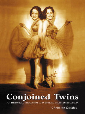 cover image of Conjoined Twins